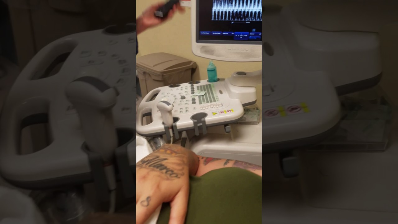 9 week ultrasound baby's heartbeat!