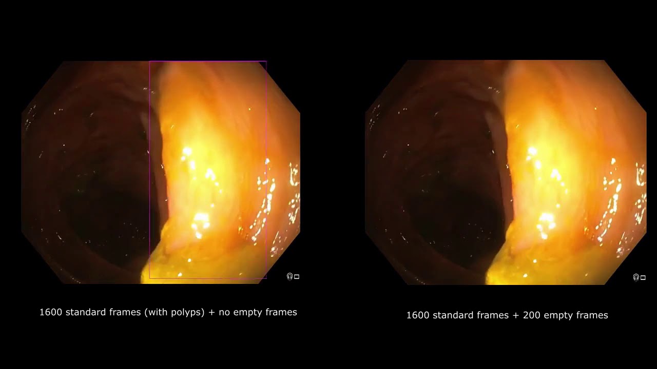 Yolo object detection industrial applications and I object