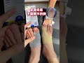 Premium Silicone Bunion Corrector Sleeve for Pain Relief &amp; Toe Alignment