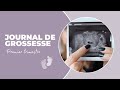 Journal de grossesse  1er trimestre