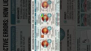 #Refractive Errors#Vision Correction #Eye Care #MedicalStudent #HealthTips #@Nurses Artistry #Shorts