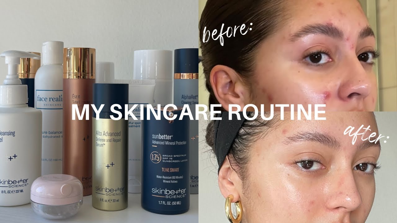 Мой утренний и вечерний уход за кожей | Кистозное, гормональное акне | Слоан Берд
