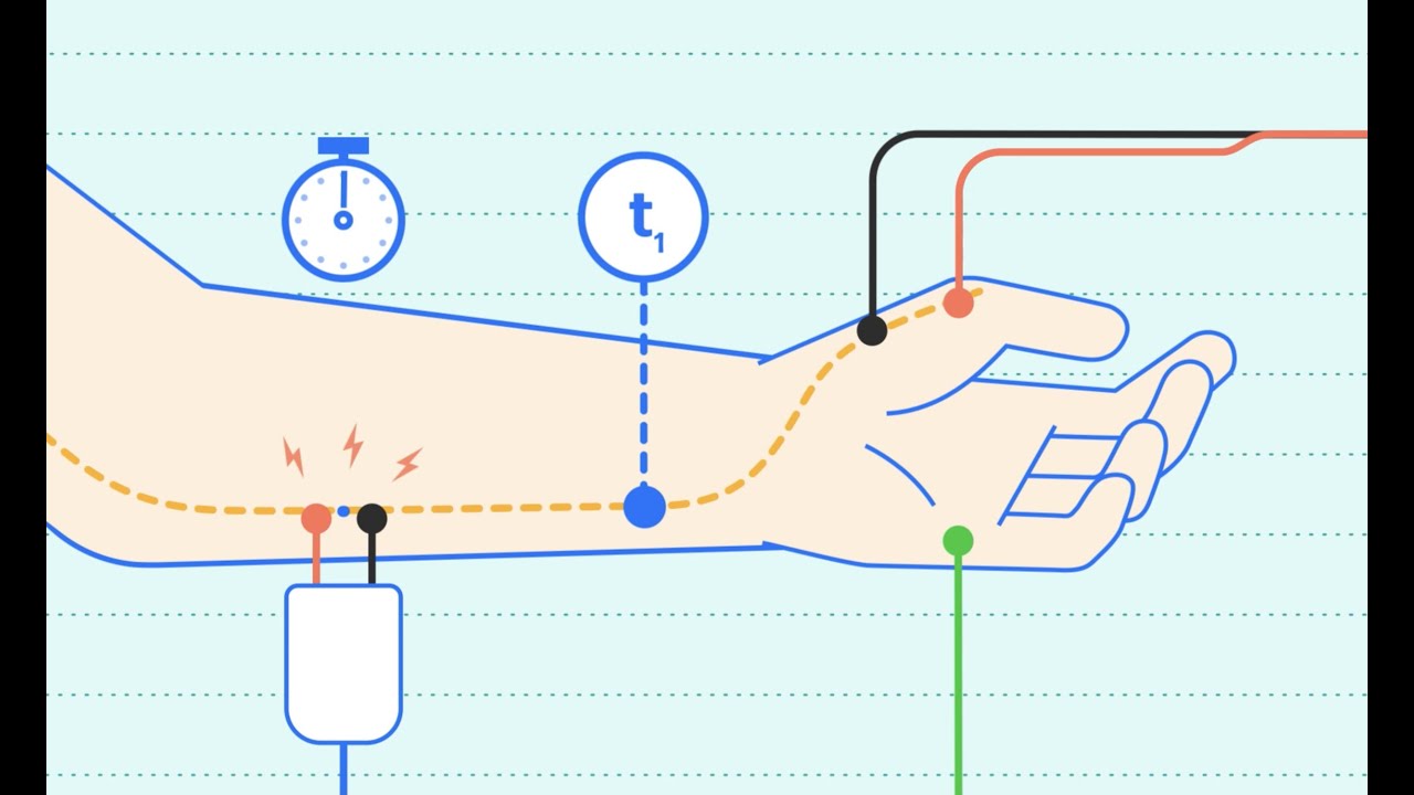 Episode 4- Le diagnostic des neuropathies auto-immunes chroniques