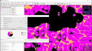 Pixel classification with QuPath (epithelium and stroma segmentation in fluorescence images)