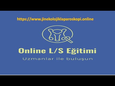 Derin Yerleşimli Endometriozisi Ultrason ile tespit edebilirsiniz.