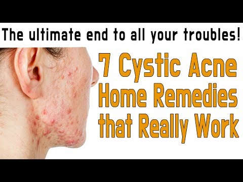  Cystic Acne Home Remedies that Really Work