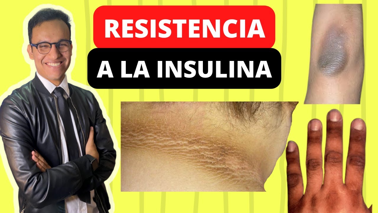Alimentacion resistencia a la insulina