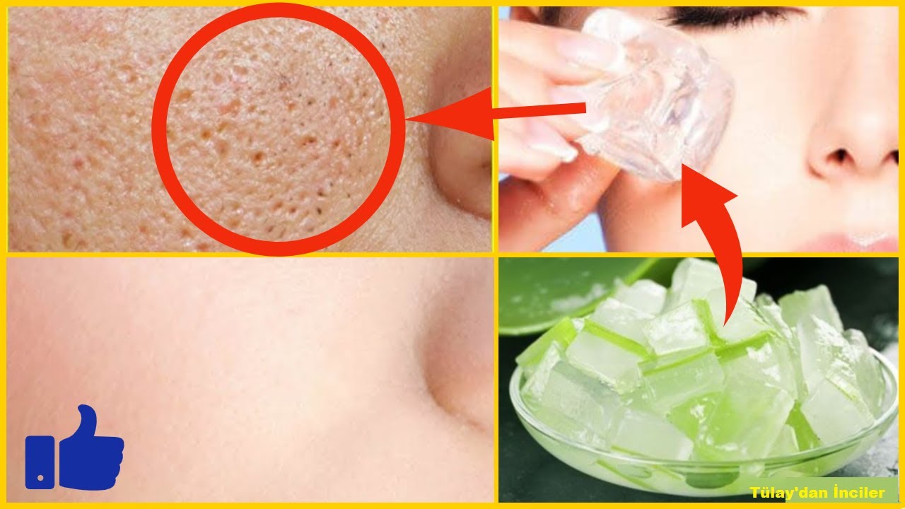 suc de aloe vera beneficii Supliment detoxifiant, din suc ecologic de Aloe Vera cu pulp  LIFE CARE