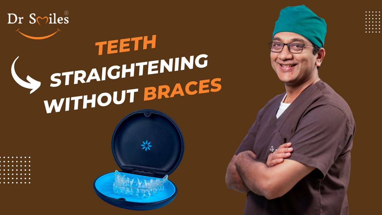 Teeth Straightening Without Braces Invisalign Aligners Hyderabad Dr