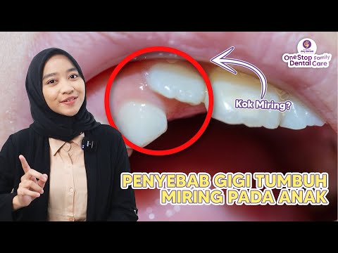 KENAPA GIGI ANAK BISA MIRING?