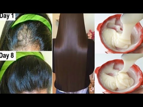 Hint Sırrı 🌿 Saçları Roket Hızıyla Uzatmak ve İlk Haftadan İtibaren Kelliği Tedavi Etmek !