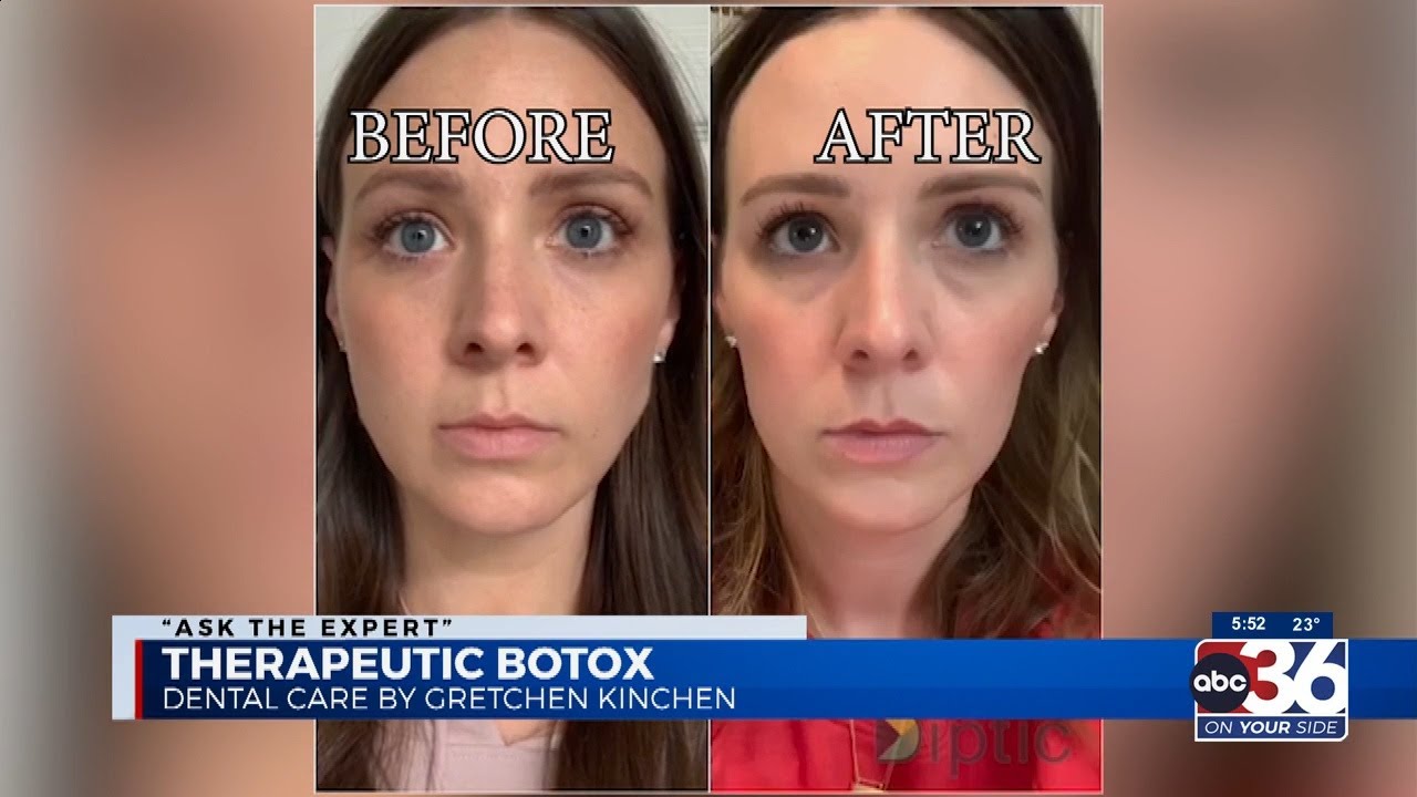 Ask The Expert Dental Care by Gretchen 3/15/23 YouTube