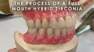 The Process of a Full Mouth Hybrid Zirconia