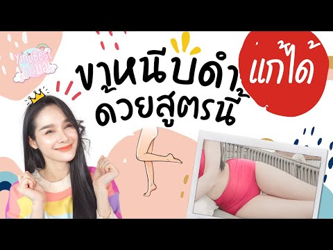 ขาหนีบดำ ทำไงให้ขาว?? แชร์วิธีแก้ขาหนีบดำ ที่ได้ผลดีที่สุด? แจกสูตรธรรมชาติ ทำง่ายๆ ขาวขึ้นจริง‼️