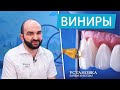 Виниры - плюсы и минусы. Зачем и когда устанавливать | часть 1