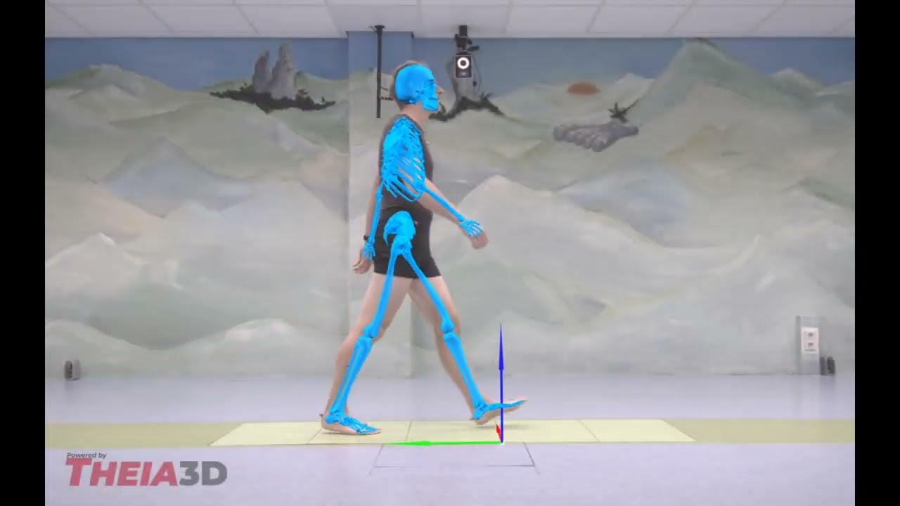 Clinical Gait Lab Amsterdam UMC