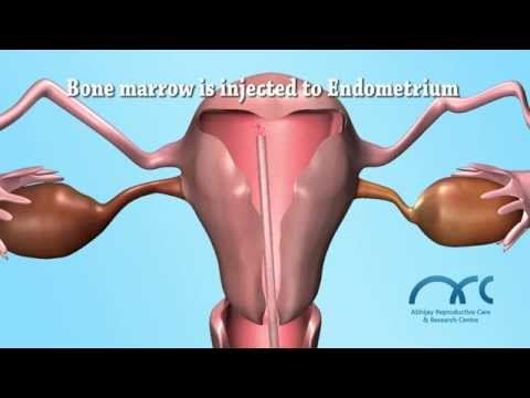 endometrium
