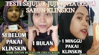 REVIEW SABUN KLINSKIN SETELAH PEMAKAIAN 1BULAN