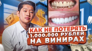 КАК ПРАВИЛЬНО ВЫБРАТЬ ВИНИРЫ? СОВЕТЫ СТОМАТОЛОГА