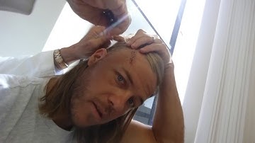Recovery ep 1: Getting my Craniotomy Staples Removed!