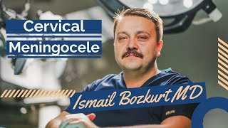 Surgical Video - Extremely Rare Case Of Cervical Meningocele In Adult Patient