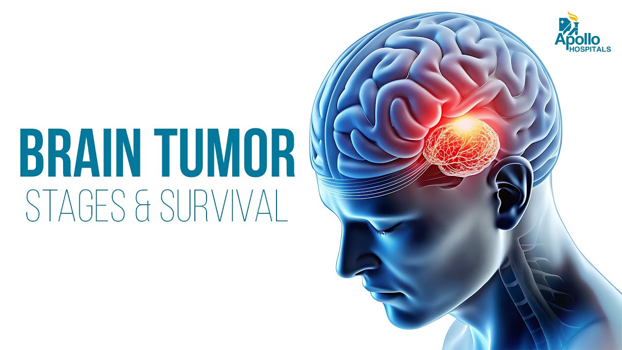 #ApolloHospitals Stages of Brain Tumor: Symptoms & Survival Chances Explained