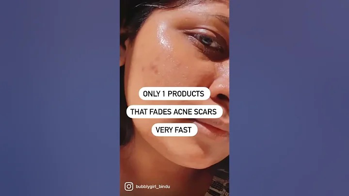 Only 1 product that fades Acne scars/Dark spots very fast #shorts #acnescars #darkspots - DayDayNews