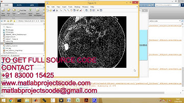Matlab code for Retinal Image Quality Analysis for Automatic Diabetic Retinopathy Detection