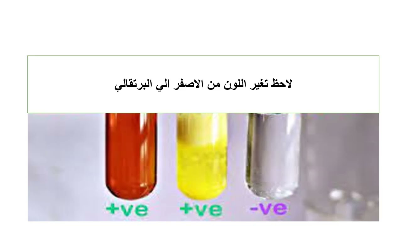 الجزء الثاني /البروتينات (الكشف الوصفي عن الاحماض الامينية)