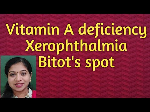 Video: Hva betyr ordet xeroftalmisk?
