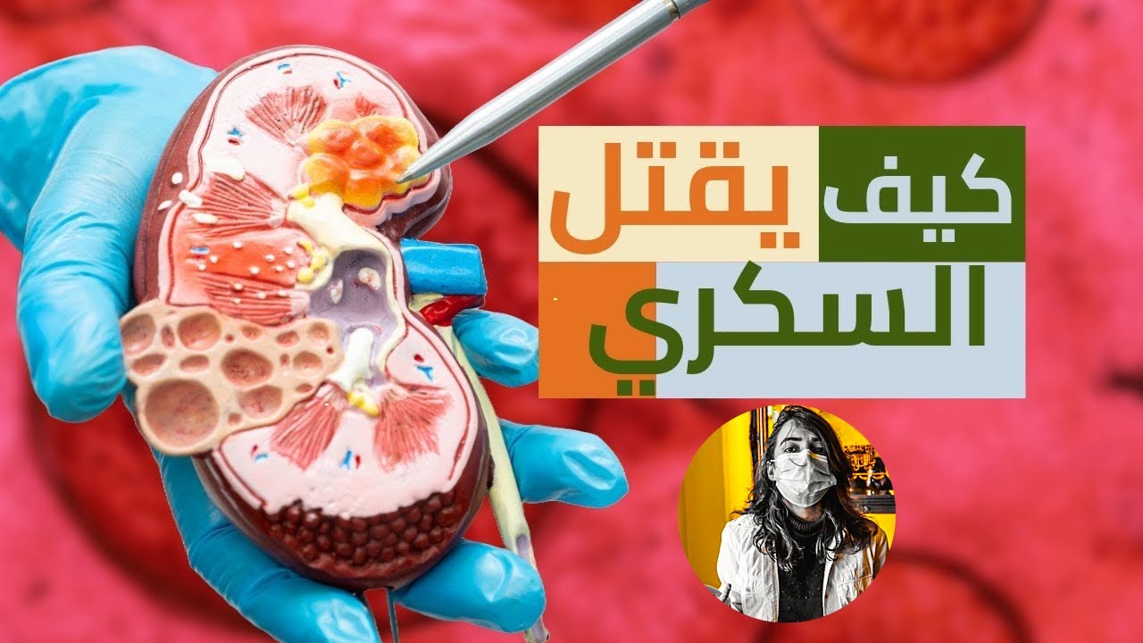 ٣١٥ مليون مريض سكري في العالم، و هكذا بدأت جزء ١