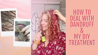 How to deal with dandruff &amp; my DIY treatment