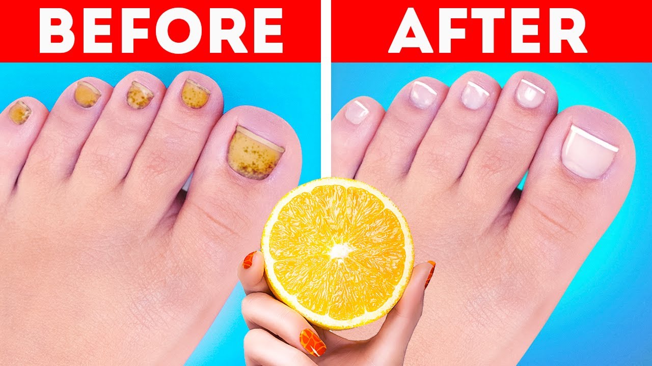 Clever hacks to take care of your feet