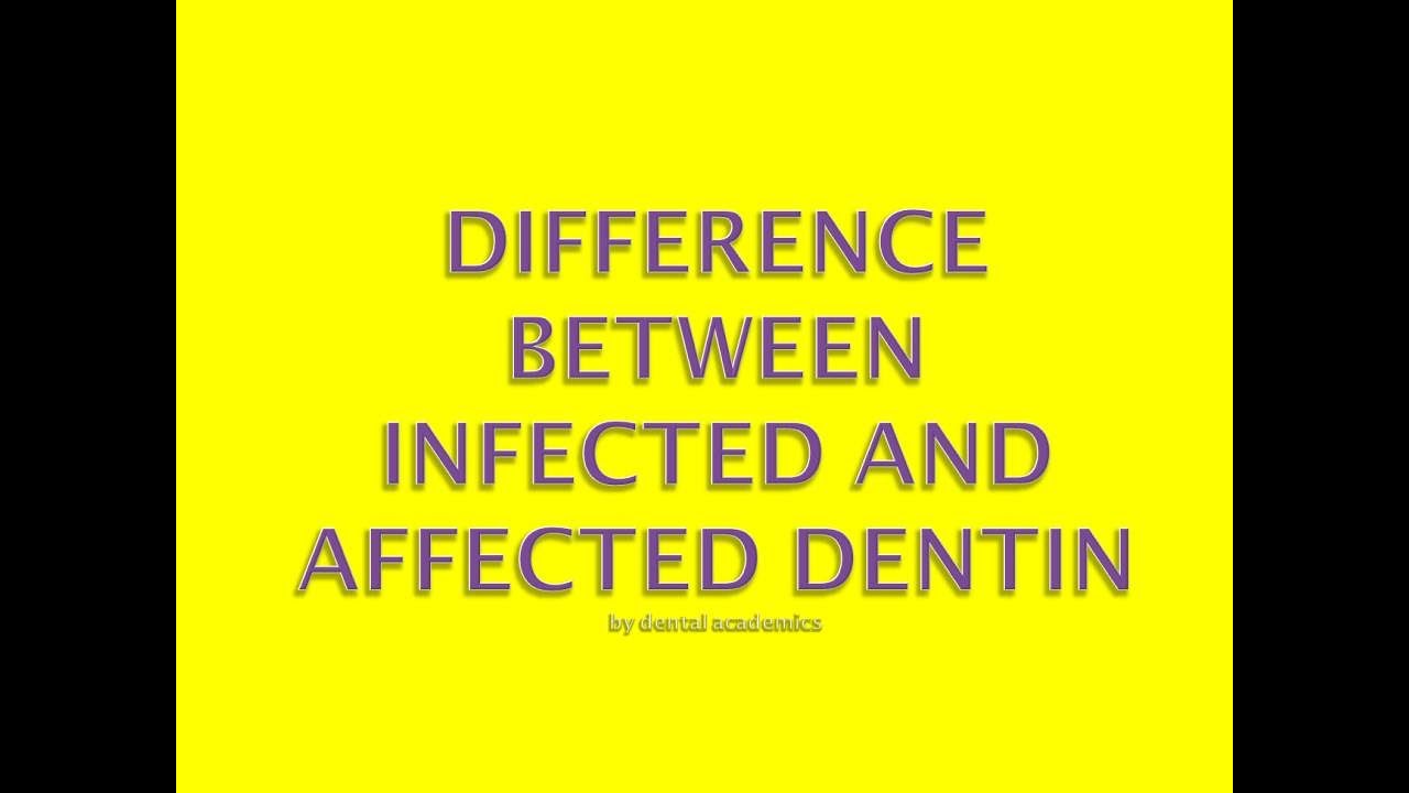 Difference between infected and affected dentin YouTube