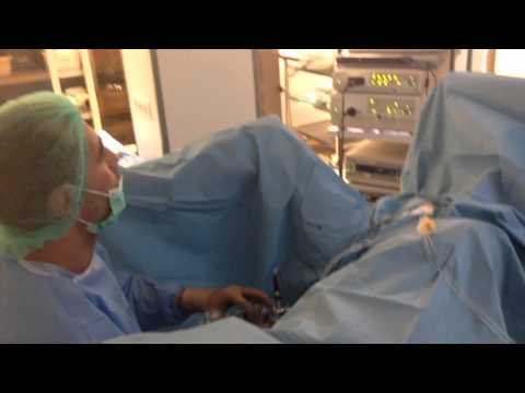 Видео: Импотентност и възстановяване след хирургия на простатата