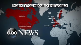 Concerns over monkeypox in the United States
