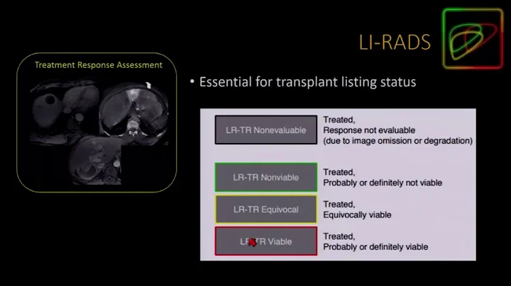 Whats New in LI-RADS?-- Kathryn Fowler, MD (SABI 4...