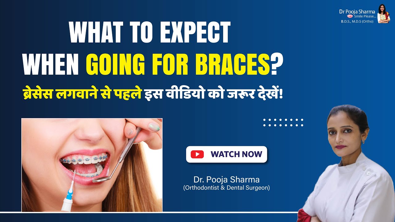 Must Watch This Video If You Are Going For Braces Treatment Best