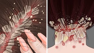 ASMR -妙に満足しちゃうフケ掻き仕草