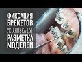 Брекеты– фиксация, установка дуг, разметка моделей | стоматология и ортодонтия самара влог