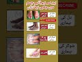 😱foot Health Signs In Urdu#shortfeed #healthcare #medical #medicine #doctor #footinfection#shorts