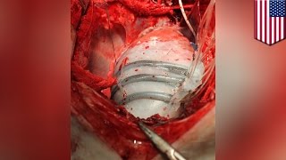 Robot heart: Soft robotic sleeve helps simulate heart beating to push blood through - TomoNews