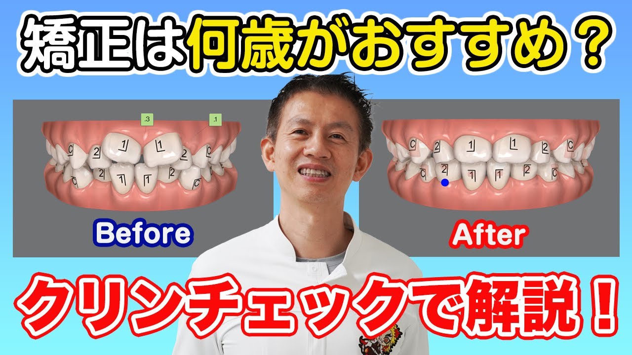 矯正治療を始める年齢は？ - YouTube