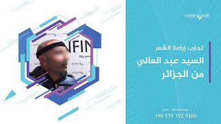 زراعة الشعر في تركيا 2018 | تجربة السيد عبد العالي بعد عملية زراعة الشعر في اسطنبول