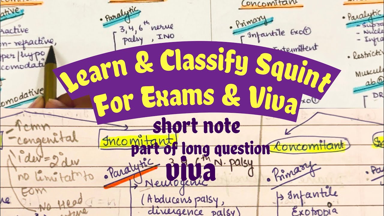 Part 1 Quick Squint Classification | 3-Minute Exam Flowchart | MS/DNB Ophthalmology