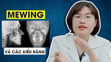 MEWING Phù hợp với những kiểu răng nào?