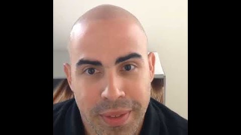 3D Scalp Micropigmentation Incredible Textured FIRST w/Chris