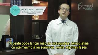 Dr. Eduardo Cerveira - Tendinite Calcárea Dr. Eduardo Cerveira - Tendinite Calcárea