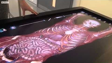 Virtual surgery How to dissect a digital cadaver