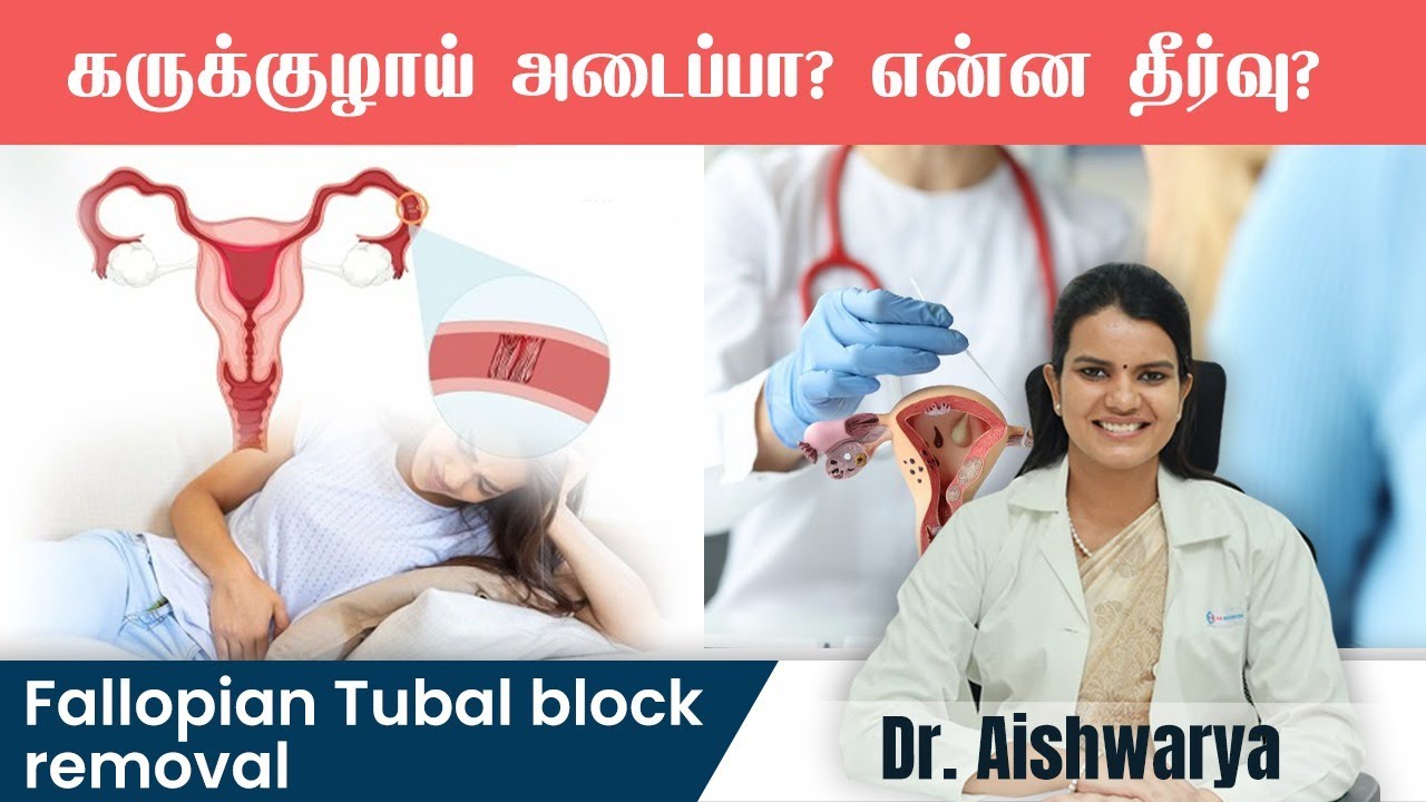 கருக்குழாய் அடைப்பு என்ன  தீர்வு? | Tubal block treatment in Tamil | Dr.Aishwarya